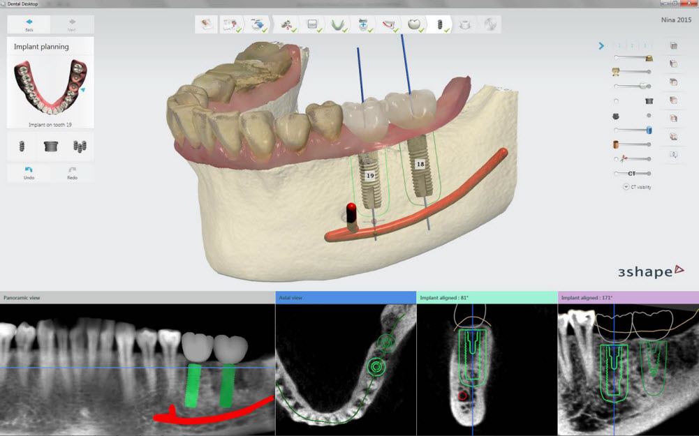 Implant Studio Adds DENTSPLY Implants Aegis Dental Network