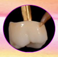 How to Guide for Achieving Lifelike Results with Pre-shaded Zirconia Ebook Library Image