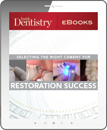 Selecting the Right Cement for Restoration Success Ebook Cover
