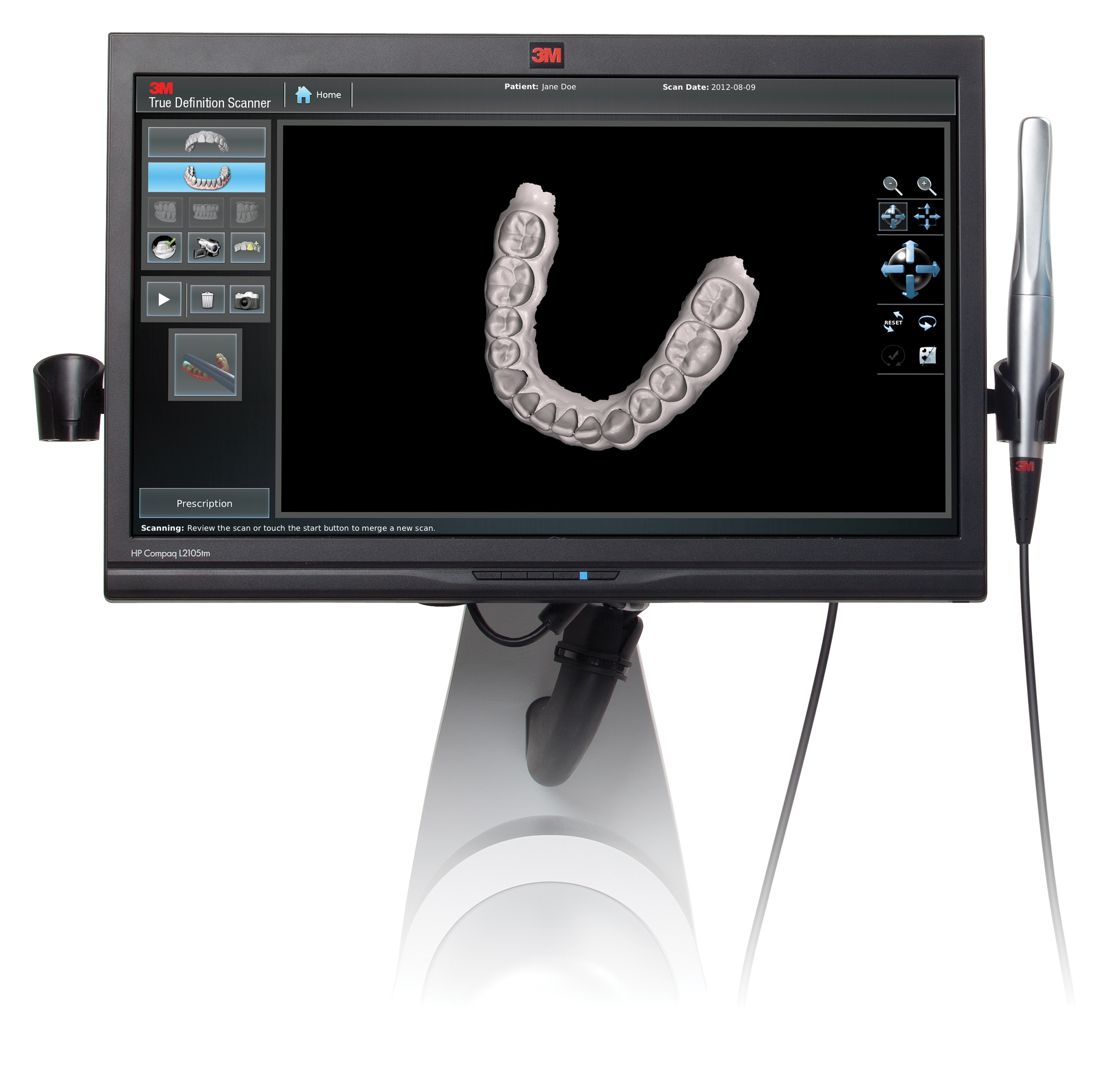 Digital Scanning Product showcase | July 2016 | Inside Dentistry