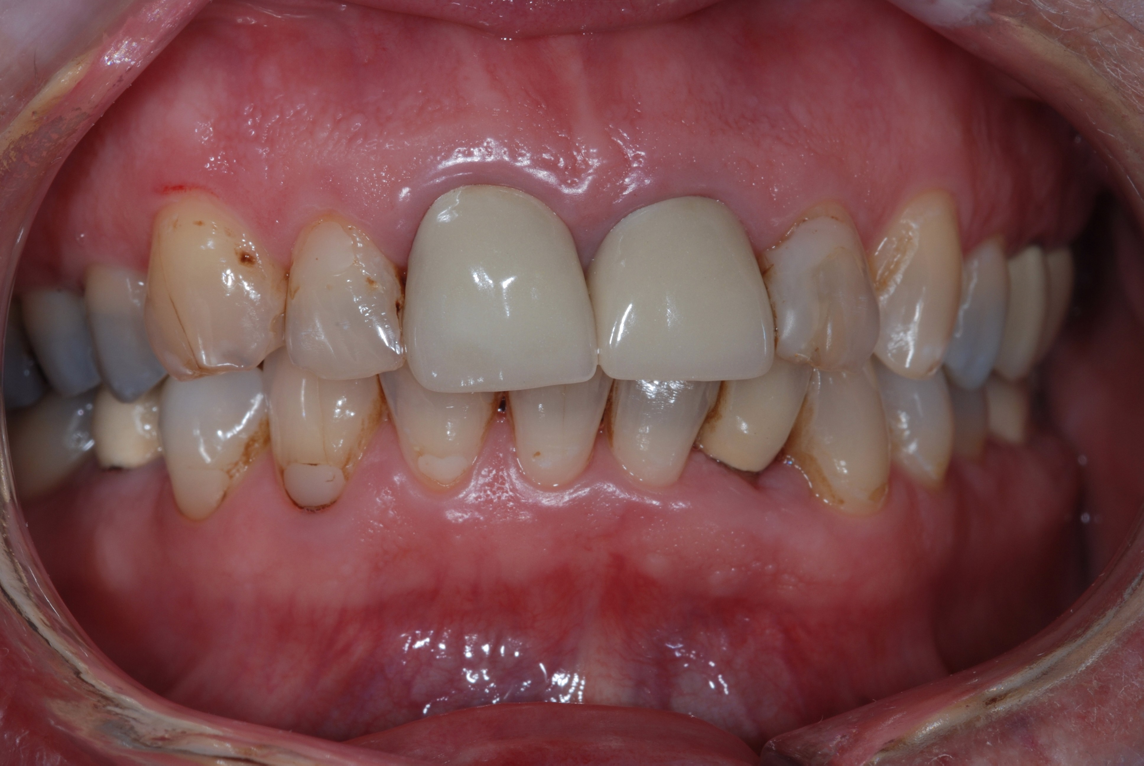 Optimal Clinical Practice for Treating Patients With Periodontal