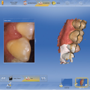 The New Zirconia Workflow: Single-Visit Chairside Restorations in 90 Minutes or Less Ebook Library Image