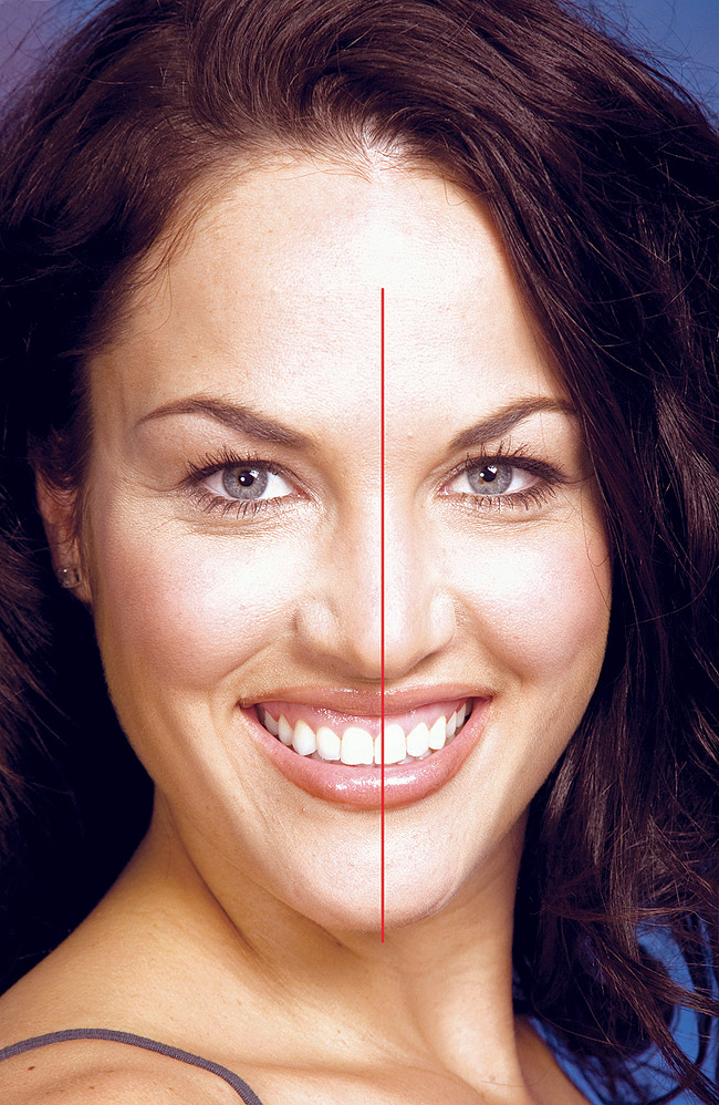 Esthetics Smile Analysis and Esthetic Design 'In the Zone' Jul/Aug