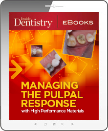 Managing the Pulpal Response with High Performance Materials Ebook Cover