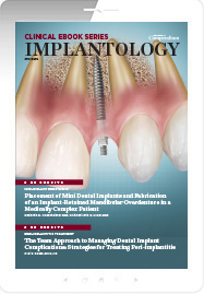 Implantology Ebook Cover