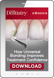 How Universal Bonding Improves Treatment Confidence Ebook Cover