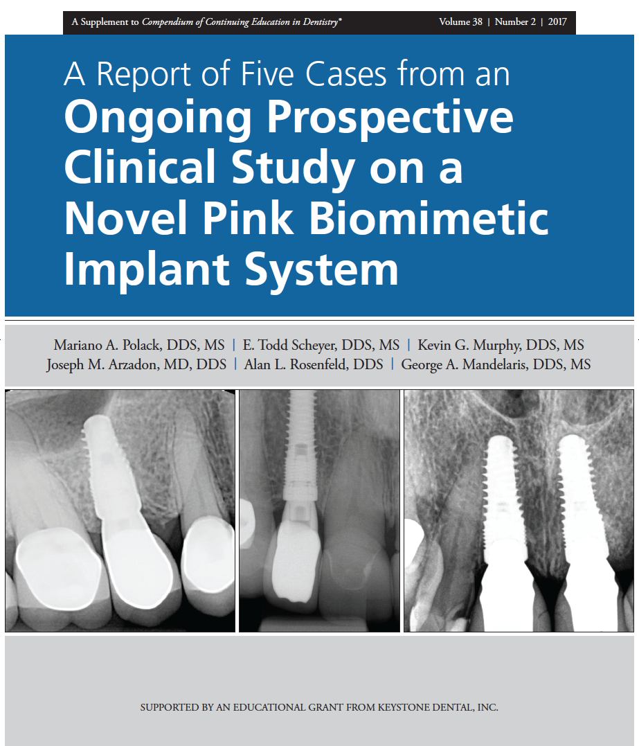 A Report of Five Cases from an Ongoing Prospective Clinical Study on a Novel Pink Biomimetic Implant System February 2017 Cover