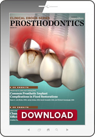Prosthodontics Ebook Cover