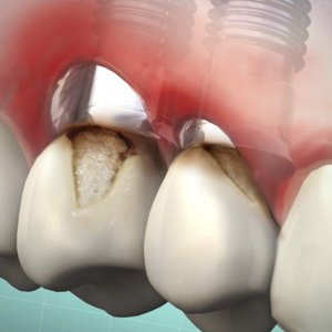 Prosthodontics Ebook Library Image