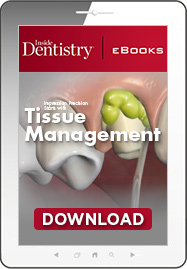 Impression Precision Starts with Tissue Management Ebook Cover