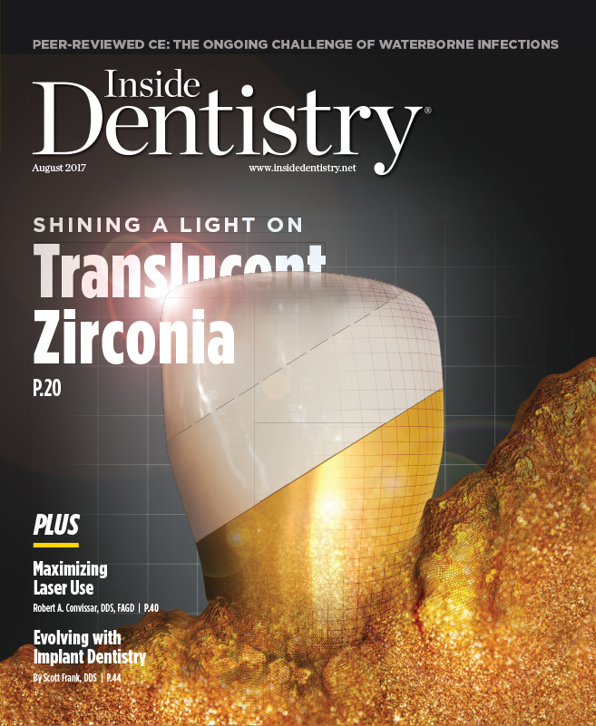 The Evolution of Adhesive Dentistry August 2017 Inside Dentistry