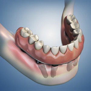 Prosthodontics 2 Ebook Library Image