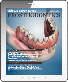 Prosthodontics 2 Ebook Cover