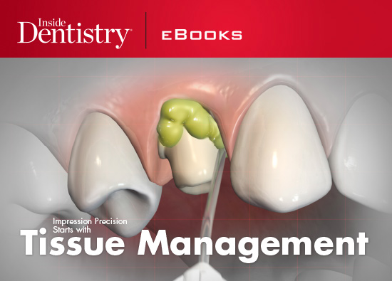 Why is tissue management important?