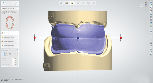 Making Digitally Designed and Fabricated Dentures a Reality
