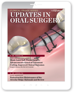 Updates in Oral Surgery Ebook Cover