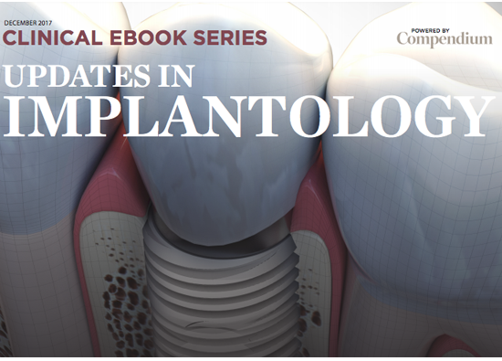 Earn CE while learning more about the factors for implant success!