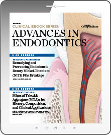 Advances in Endodontics Ebook Cover