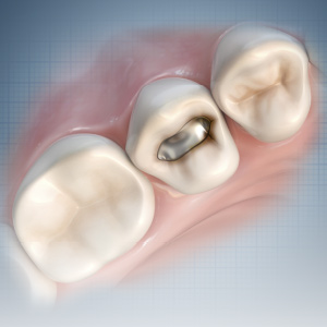 Current Topics in Restorative Dentistry Ebook Library Image
