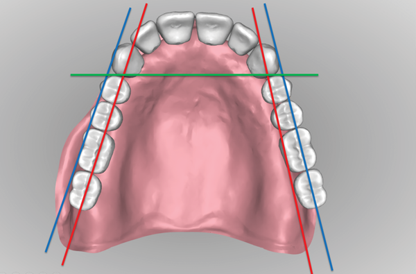 Digital Denture Diagnostics, June 2018