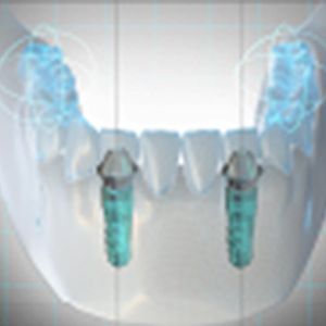 Digital Workflow and Prosthetically Driven Implant Placement Ebook Library Image