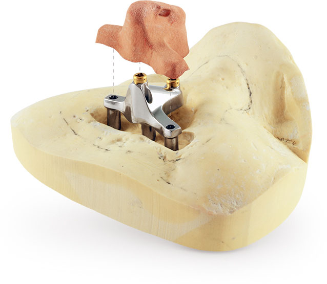 Panthera Dental Launches a New Division Panthera Implant Aegis Dental Network