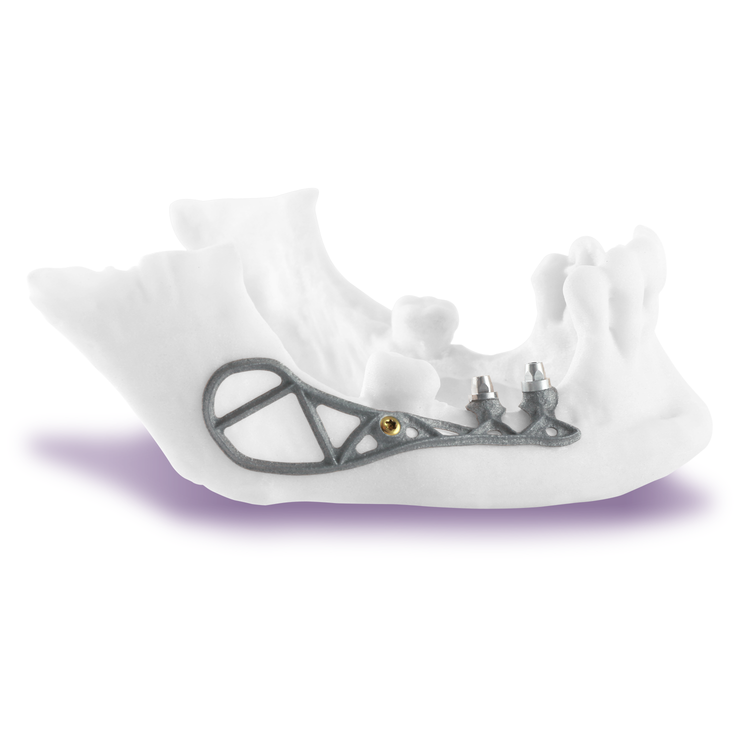 Panthera Dental Launches a New Division Panthera Implant News