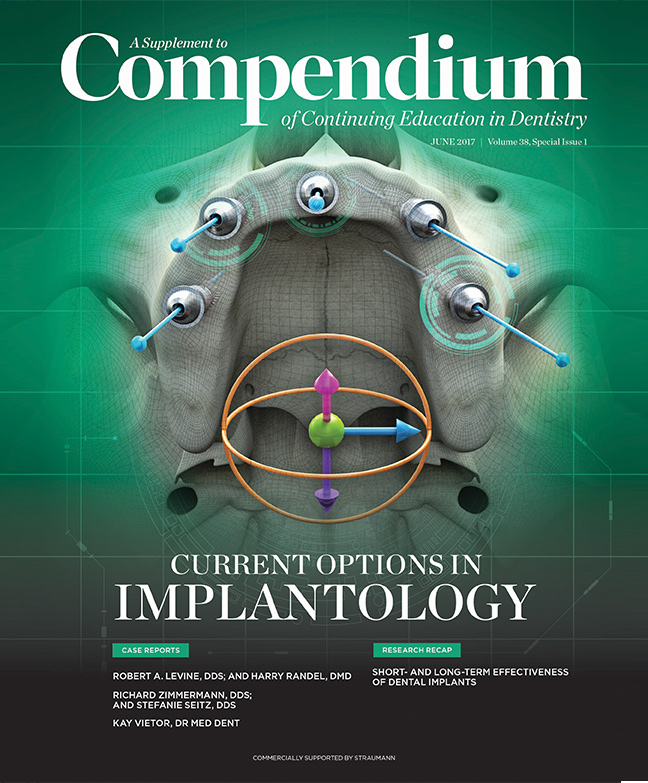 Straumann Implantology June 2017 Cover
