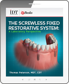 The Screwless Fixed Restorative System: A Laboratory Perspective Ebook Cover