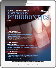 Advances in Periodontics Ebook Cover