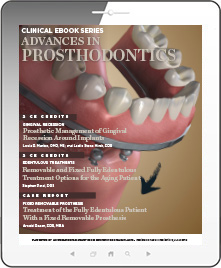 Advances in Prosthodontics Ebook Cover