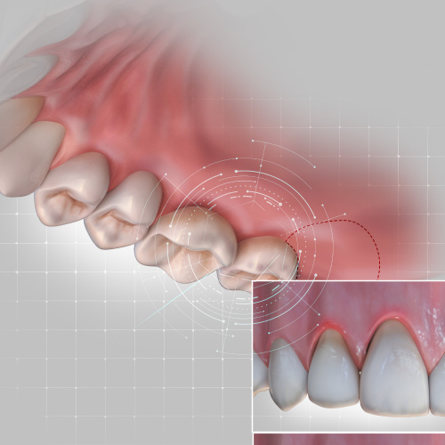 Today's Trends in Periodontics Ebook Library Image