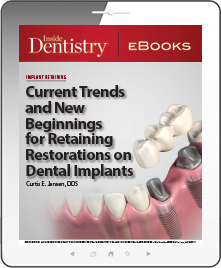 Current Trends and New Beginnings for Retaining Restorations on Dental Implants Ebook Cover