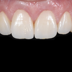 Zirconia ≠ Zirconia: But What Makes the Difference? Part 2 Ebook Library Image