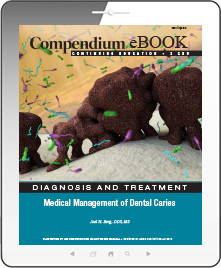 Medical Management of Dental Caries Ebook Cover