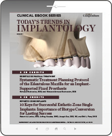 Today's Trends in Implantology Ebook Cover