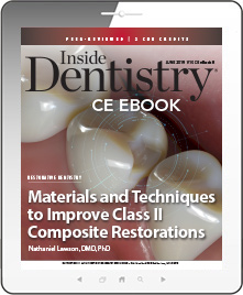 Materials and Techniques to Improve Class II Composite Restorations Ebook Cover