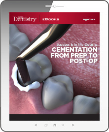 Success is in the Details: Cementation from Prep to Post-Op Ebook Cover