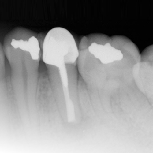 Spotlight on Endodontics Ebook Library Image