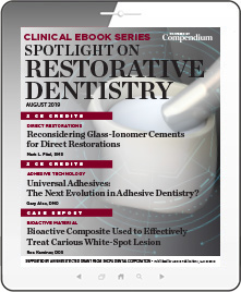 Spotlight on Restorative Dentistry Ebook Cover