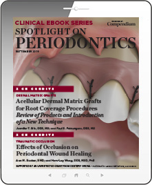 Spotlight on Periodontics Ebook Cover