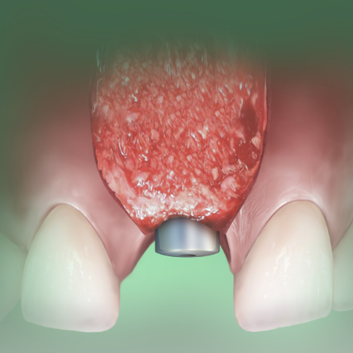 Spotlight on Oral Surgery Ebook Library Image