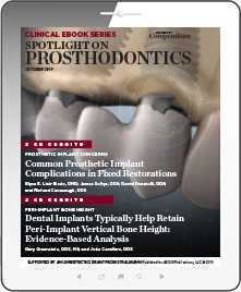 Spotlight on Prosthodontics Ebook Cover