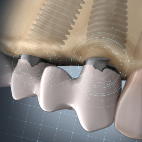 Spotlight on Prosthodontics Ebook Library Image