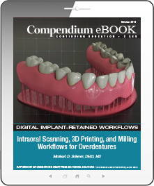 Intraoral Scanning, 3D Printing, and Milling Workflows for Overdentures Ebook Cover
