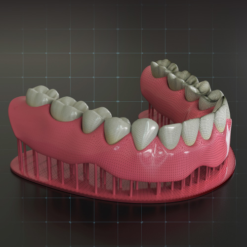 Intraoral Scanning, 3D Printing, and Milling Workflows for Overdentures Ebook Library Image