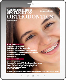 Spotlight on Orthodontics Ebook Cover