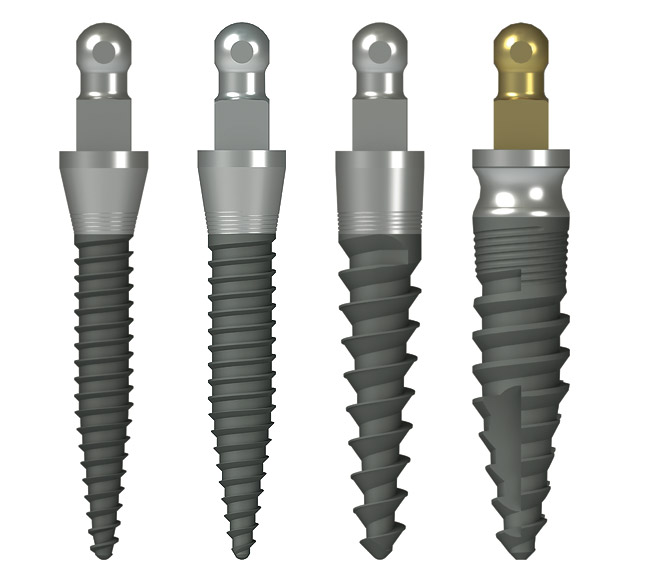 3M ESPE MDI Mini Dental Implants | November 2011 | Inside Dentistry