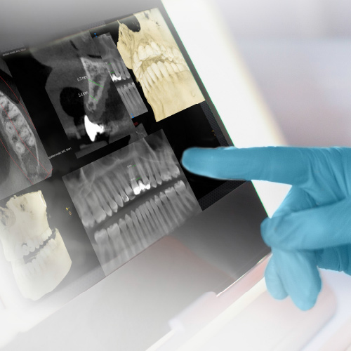 Interaction of CBCT, Intraoral Scanning, and CAD/CAM in Dentistry: An Overview Ebook Library Image