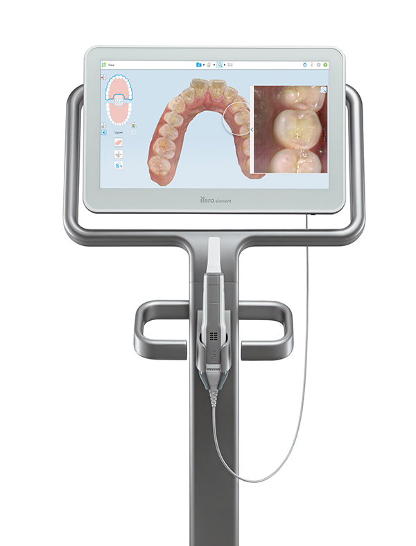 iTero® Element Intraoral Scanners Help Dentists Not Only Treat But